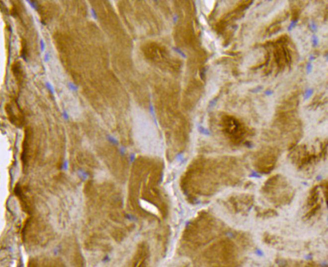 BMPR1A Antibody in Immunohistochemistry (Paraffin) (IHC (P))