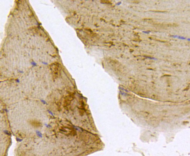 BMPR1A Antibody in Immunohistochemistry (Paraffin) (IHC (P))