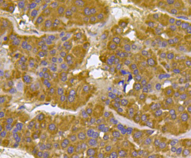 BMPR1A Antibody in Immunohistochemistry (Paraffin) (IHC (P))