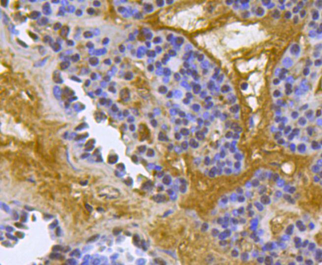 BMPR1A Antibody in Immunohistochemistry (Paraffin) (IHC (P))