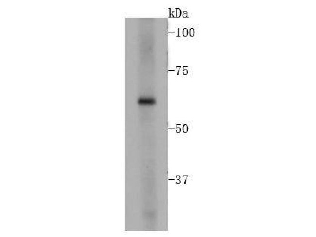 BMPR1A Antibody in Western Blot (WB)