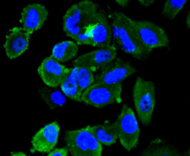 FPR2 Antibody in Immunocytochemistry (ICC/IF)