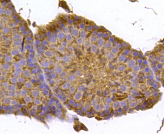 FPR2 Antibody in Immunohistochemistry (Paraffin) (IHC (P))