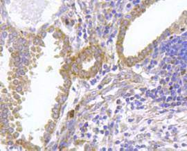 FPR2 Antibody in Immunohistochemistry (Paraffin) (IHC (P))