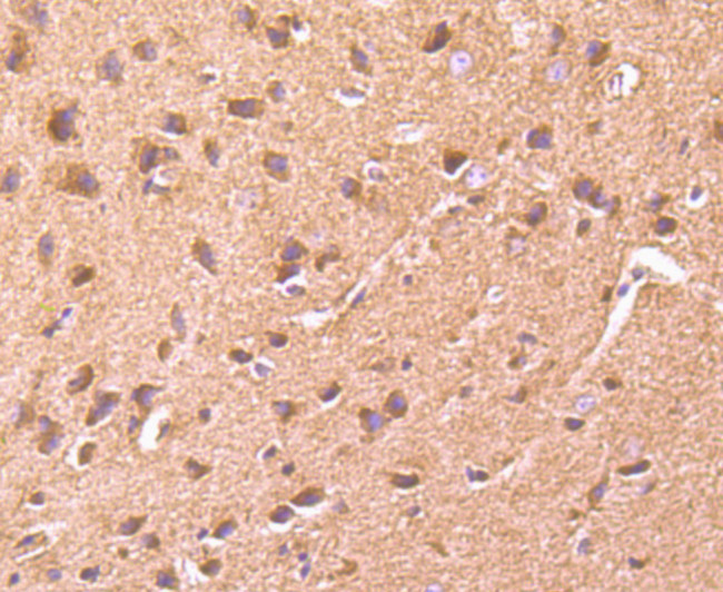 mTOR Antibody in Immunohistochemistry (Paraffin) (IHC (P))