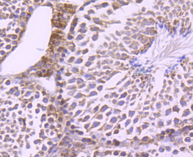 mTOR Antibody in Immunohistochemistry (Paraffin) (IHC (P))