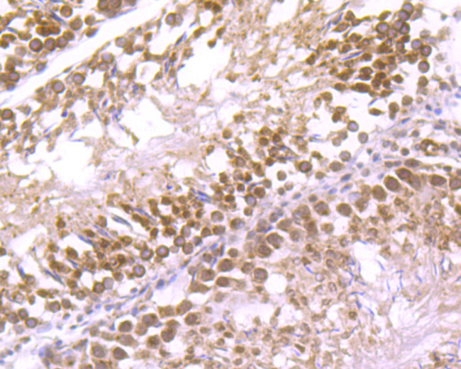 mTOR Antibody in Immunohistochemistry (Paraffin) (IHC (P))