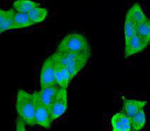 SMAD3 Antibody in Immunocytochemistry (ICC/IF)