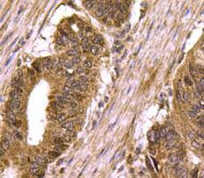 SMAD3 Antibody in Immunohistochemistry (Paraffin) (IHC (P))