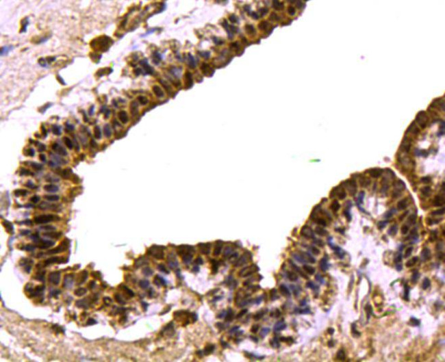 SMAD3 Antibody in Immunohistochemistry (Paraffin) (IHC (P))