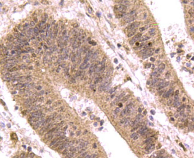 SMAD3 Antibody in Immunohistochemistry (Paraffin) (IHC (P))