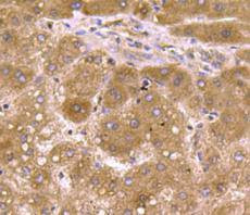 SMAD3 Antibody in Immunohistochemistry (Paraffin) (IHC (P))