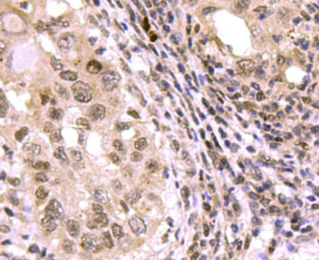 SMAD3 Antibody in Immunohistochemistry (Paraffin) (IHC (P))