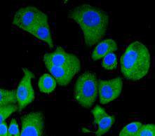 nNOS Antibody in Immunocytochemistry (ICC/IF)