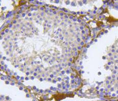 nNOS Antibody in Immunohistochemistry (Paraffin) (IHC (P))