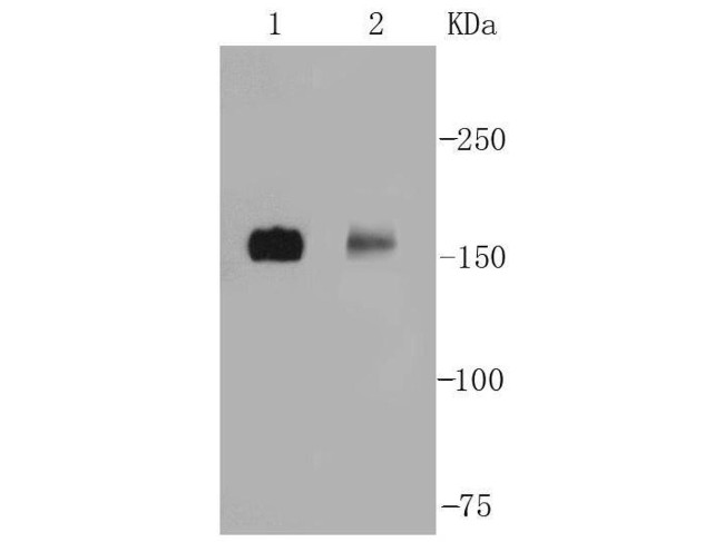 nNOS Antibody in Western Blot (WB)