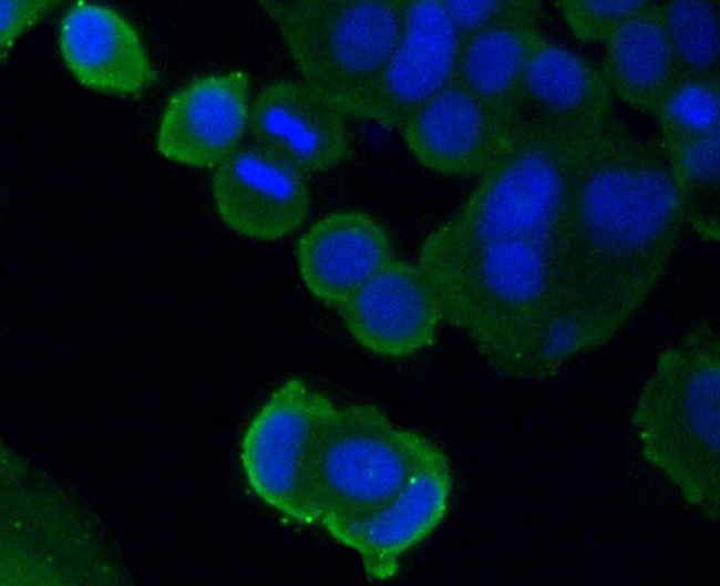 PDGF Receptor beta Antibody in Immunocytochemistry (ICC/IF)