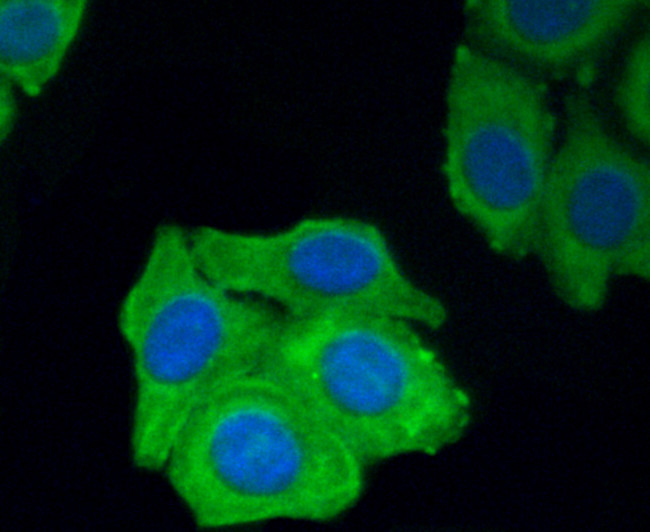 PDGF Receptor beta Antibody in Immunocytochemistry (ICC/IF)