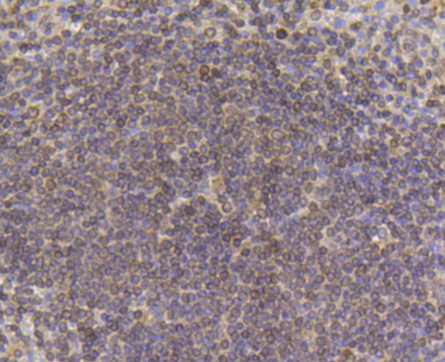 PDGF Receptor beta Antibody in Immunohistochemistry (Paraffin) (IHC (P))
