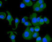 Smad2 Antibody in Immunocytochemistry (ICC/IF)