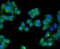 Smad2 Antibody in Immunocytochemistry (ICC/IF)