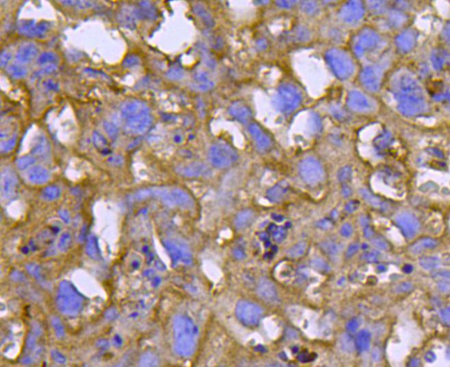 Smad2 Antibody in Immunohistochemistry (Paraffin) (IHC (P))