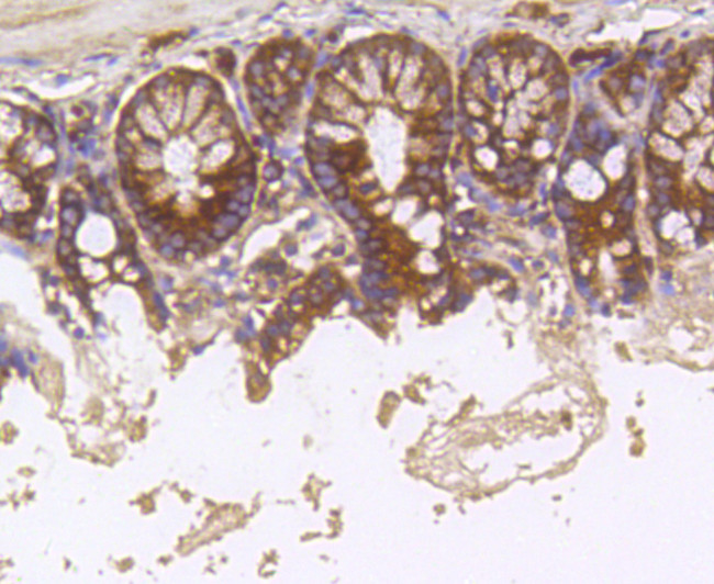 Hsc70 Antibody in Immunohistochemistry (Paraffin) (IHC (P))