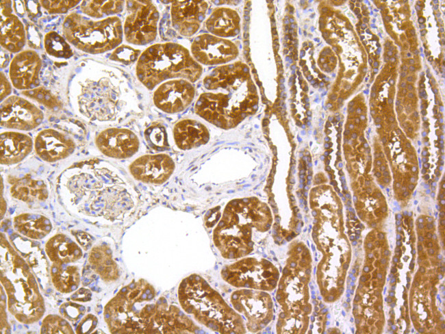 Hsc70 Antibody in Immunohistochemistry (Paraffin) (IHC (P))