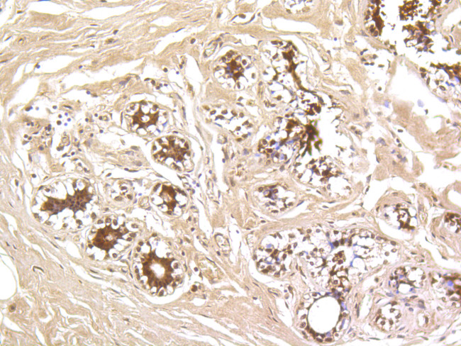 Hsc70 Antibody in Immunohistochemistry (Paraffin) (IHC (P))