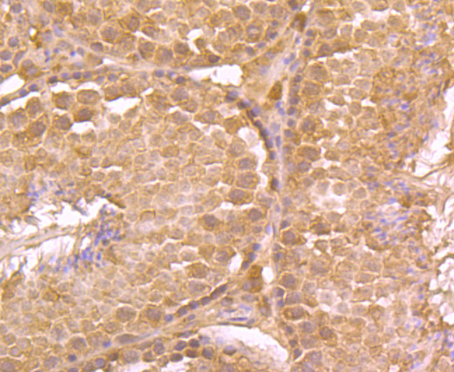 LDL Receptor Antibody in Immunohistochemistry (Paraffin) (IHC (P))