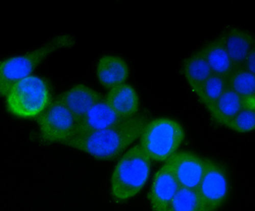 RON Antibody in Immunocytochemistry (ICC/IF)