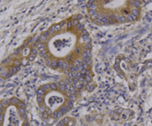 RON Antibody in Immunohistochemistry (Paraffin) (IHC (P))