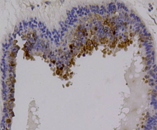 RON Antibody in Immunohistochemistry (Paraffin) (IHC (P))