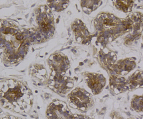 RON Antibody in Immunohistochemistry (Paraffin) (IHC (P))