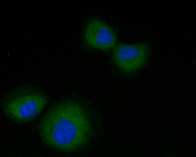 GPCR RDC1/CXCR-7 Antibody in Immunocytochemistry (ICC/IF)