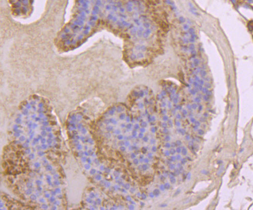 Hsc70 Antibody in Immunohistochemistry (Paraffin) (IHC (P))