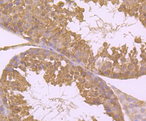 Hsc70 Antibody in Immunohistochemistry (Paraffin) (IHC (P))