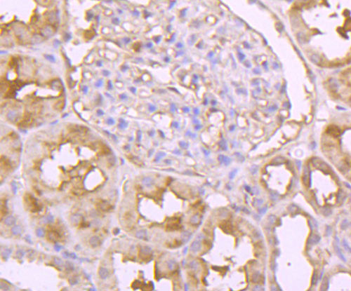 Hsc70 Antibody in Immunohistochemistry (Paraffin) (IHC (P))