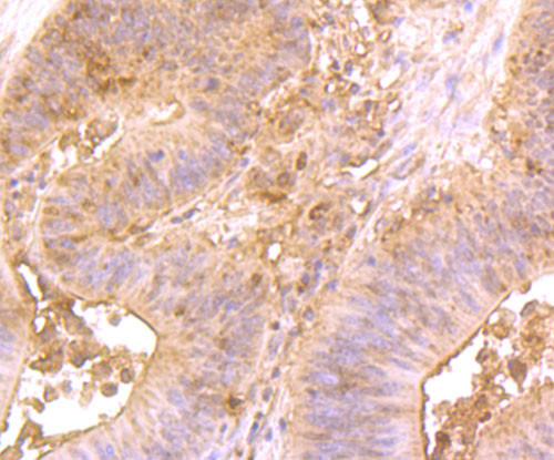 Hsc70 Antibody in Immunohistochemistry (Paraffin) (IHC (P))