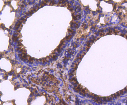 EGFR Antibody in Immunohistochemistry (Paraffin) (IHC (P))