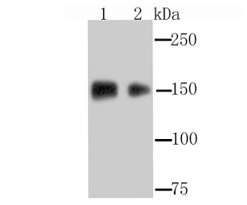 EGFR Antibody in Western Blot (WB)