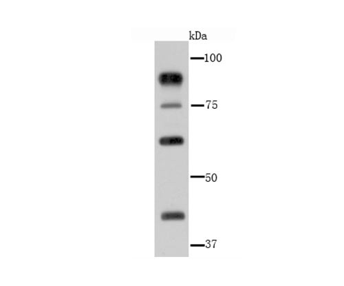 Glucocorticoid Receptor alpha Antibody in Western Blot (WB)