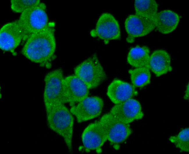 Tyrosine Hydroxylase Antibody in Immunocytochemistry (ICC/IF)