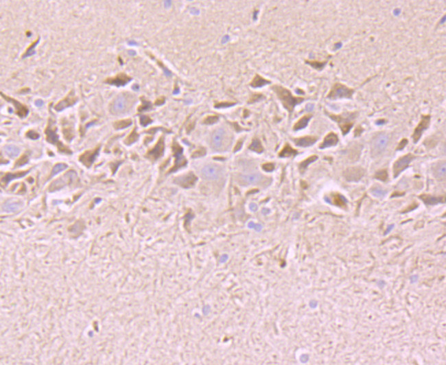 Tyrosine Hydroxylase Antibody in Immunohistochemistry (Paraffin) (IHC (P))