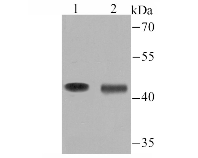 Tyrosine Hydroxylase Antibody in Western Blot (WB)