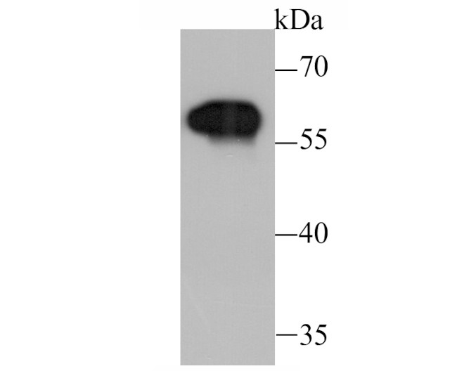 Tyrosine Hydroxylase Antibody in Western Blot (WB)