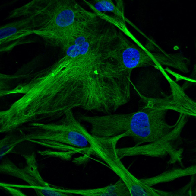 Mouse IgG (H+L) Secondary Antibody in Immunocytochemistry (ICC/IF)