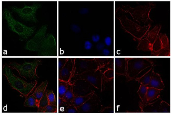 Mouse IgG (H+L) Secondary Antibody in Immunocytochemistry (ICC/IF)