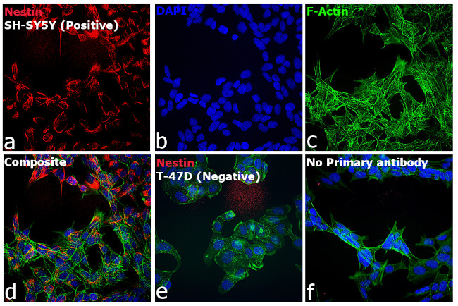 Mouse IgG (H+L) Secondary Antibody in Immunocytochemistry (ICC/IF)