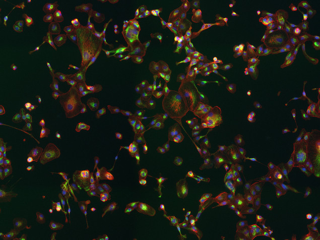 Rabbit IgG (H+L) Cross-Adsorbed Secondary Antibody in Immunocytochemistry (ICC/IF)